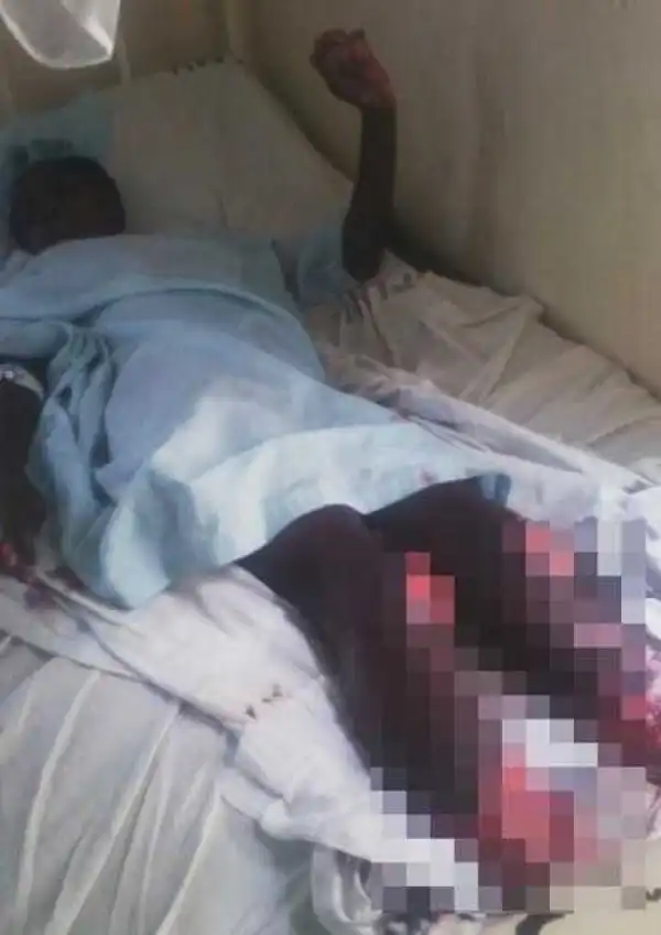 Evil World: Woman Pours Acid on Her Daughter-in-law and Locks Her Inside Room for Two Weeks to Rot (Photo)